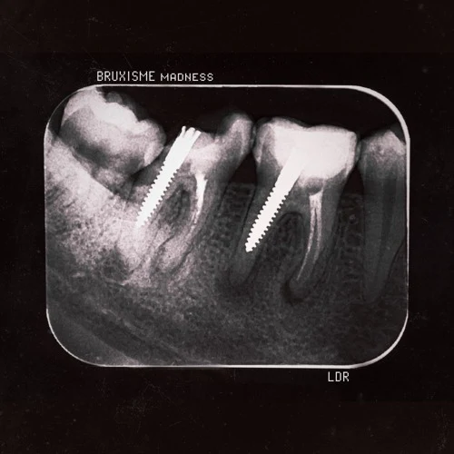Lextape : BRUXISME Madness